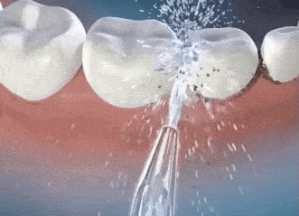 LIMPIADOR IRRIGADOR DENTAL PORTÁTIL - AquaSmile