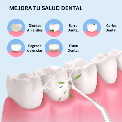 LIMPIADOR IRRIGADOR DENTAL PORTÁTIL - AquaSmile